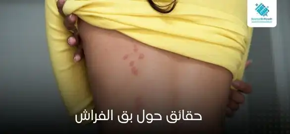 حقائق حول بق الفراش